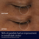 Estée Lauder Advanced Night Repair Eye Gel-Cream – Target Dark Circles & Signs of Aging