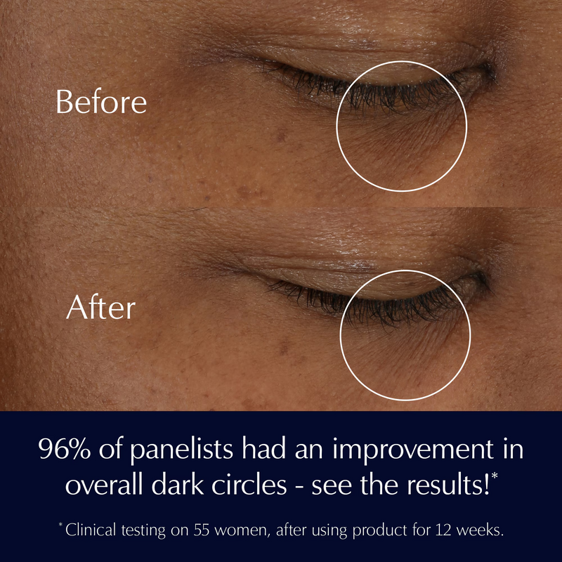Estee Lauder Advanced Night Repair Eye Supercharged Complex