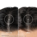 Klorane Shampoo Chininastella Alpina Bio 400 Ml Strength Thinning Hair Loss Shampoo